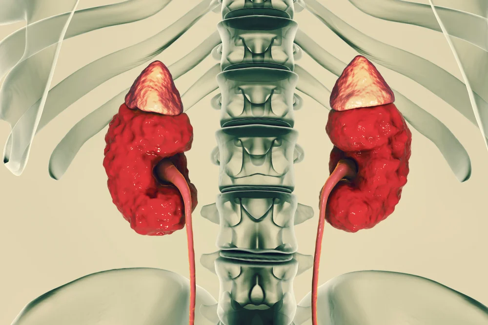 Chronic Kidney Disease